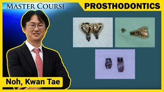 Master Course Season2 PROSTHODONTICS Screw Loosening amp Fracture  Causes and Solutions [upl. by Stanhope]