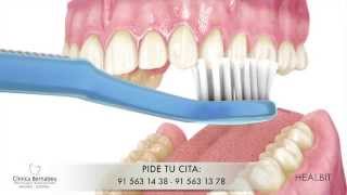 Limpieza dental  Recomendaciones [upl. by Auqkinahs]