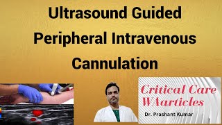 Ultrasound Guided Peripheral Intravenous Cannulation [upl. by Acire]