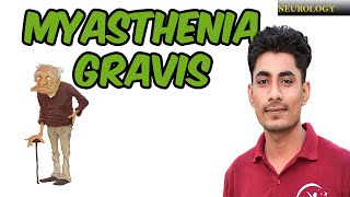 MYASTHENIA GRAVIS  SIGN AND SYMPTOM  MANAGEMENT [upl. by Gitel]