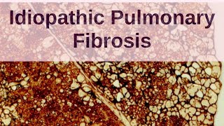 What is Idiopathic Pulmonary Fibrosis  Pathology mini tutorials [upl. by Hairom659]