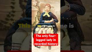 The Incredible Life of Myrtle Corbin The FourLegged Womanfacthistory Uniquelady [upl. by Varhol234]