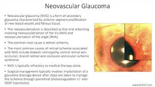 Lecture Neovascular Glaucoma 1 Slide in 5 Minutes [upl. by Nysila]