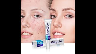 BIOAQUA Anti Acne Cream  Acne Scar Removal Cream  bioaqua acnetreatment acnescars pimple [upl. by Bysshe506]