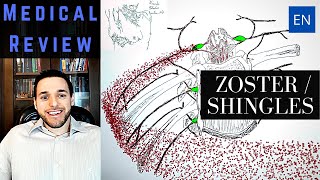 Varicella Zoster Virus and Shingles [upl. by Bathsheba664]