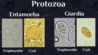 microscopical exam Protozoal trophozoites amp cysts [upl. by Halimeda768]