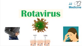 Rotavirus  Risk Factors Pathophysiology Symptoms Diagnosis Treatment [upl. by Burr]