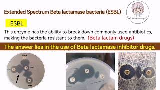 ESBL bacteria Extended Spectrum Betalactamase Bacteria  Antibiotic Resistance English [upl. by Okimik]