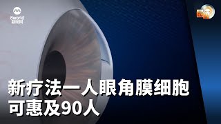 晨光第一线 新疗法一人眼角膜细胞可惠及90人 [upl. by Aserehs]