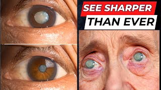 See Sharper Than Ever 👁 10 Superfoods to Supercharge Your Eye Health [upl. by Ahsrat]