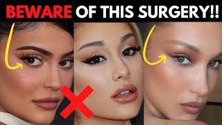 Why Youll REGRET Getting this Trendy Plastic Surgery Procedure Fox eye surgery trend [upl. by Alitha]