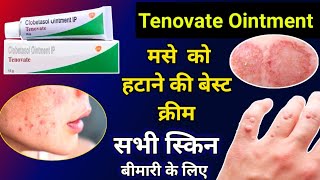 Tenovate Cream Uses In Hindi  स्किन की Fungal Infection के लिए जरूर ले  Full information [upl. by Okiek]