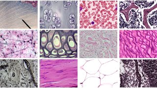 Practice Identifying Connective Tissue Complete [upl. by Annaiel]