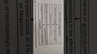 Pathophysiology of Megacolonhirschsprungs diseassy [upl. by Auqinahc]