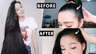 How I Grew Back My Hairline amp Prevent Receding Hairline [upl. by Feirahs]