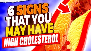 High Cholesterol Alert 6 Symptoms You Shouldnt Ignore [upl. by Normac]