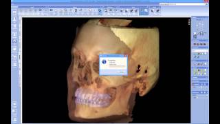 Quick launch 3D volume with 3D photo and impression scans from Planmeca Romexis® to Dolphin Imaging [upl. by Ahsram]