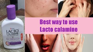 Lecto Calamine Lotion UsesBest 5 Way to Use On SkinNo More Dry pigmentedItcy Skin [upl. by Eah]