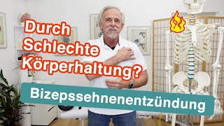 Bizepssehnenentzündung ⚡ Durch schlechte Körperhaltung  Übungen und Tipps [upl. by Erhard201]