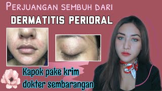 DERMATITIS PERIORAL KARENA KRIM PEMUTIH Cara lepas dan sembuh dari dermatitis perioral [upl. by Retha104]