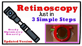 Updated Retinoscopy just in 3 Simple Steps [upl. by Nelav702]