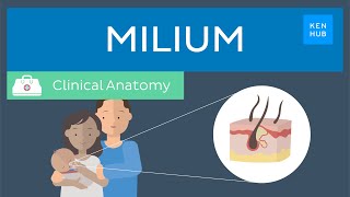 Milium Definition symptoms treatment and management  Kenhub [upl. by Sammie602]