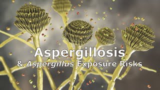 Aspergillosis and Aspergillus Exposure Risks [upl. by Aylsworth]