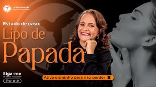 Estudo de caso Pós lipo de Papada [upl. by Edna67]