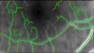 vessel centerline extraction based on distance transformations [upl. by Anuaek]