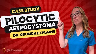 Case study 124  Pilocytic astrocystoma diagnosis amp treatment EXPLAINED by Dr Grunch neurosurgeon [upl. by Hibbs886]