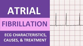 Atrial Fibrillation AFib ECG Treatment Causes Nursing NCLEX Review ACLS [upl. by Eirot]