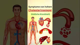 Symptome von hohem cholesterinspiegel [upl. by Kristopher]