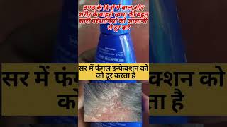 सर की रुसी को दूर करें  dandruff treatment  candid tv suspension treatment of tinea versicolor [upl. by Lowrance]