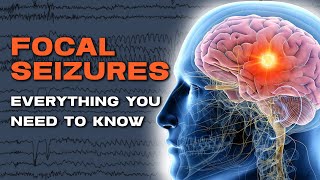 The Truth About Focal Automatism Seizures [upl. by Vadim549]