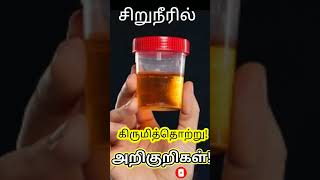 Urine infection in TamilUrinary Tract Infection TamilUrine Culture testUrine infection Symptoms [upl. by Atnuahsal760]