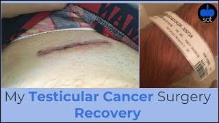 My Testicular Cancer Surgery Recovery [upl. by Igic216]