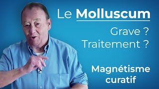 Le Molluscum Expliqué et Comment sen Débarrasser [upl. by Domineca854]