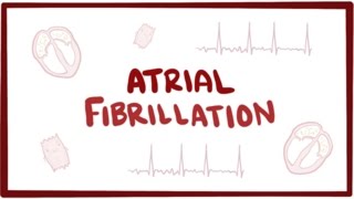 Atrial fibrillation Afib AF  causes symptoms treatment amp pathology [upl. by Nylahsoj]