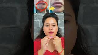 📛♨️Antiaging glowing skin yoga reduce chin wrinkleswithout botox ❌💉injection try 🤯it daily shorts [upl. by Eerazed318]