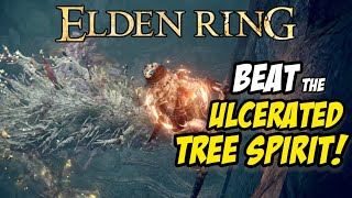 Beat the ULCERATED TREE SPIRIT in the Stormveil Castle Basement  Elden Ring [upl. by Mulford]