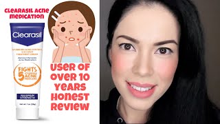 Clearasil Stubborn Acne Control 5 in 1 treatment Review [upl. by Soneson]