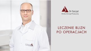 Leczenie blizn po operacjach chirurgii plastycznej [upl. by Yecnahc662]