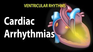 Cardiac Arrhythmias Animation [upl. by Nirrek]