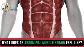 Part 76 What does an abdominal muscle strain feel like  DR MAI [upl. by Savil152]