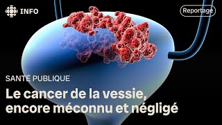 Le cancer de la vessie encore méconnu et négligé [upl. by Erlina]