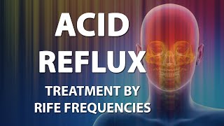 Acid Reflux GERD  RIFE Frequencies Treatment  Energy amp Quantum Medicine with Bioresonance [upl. by Lemon242]