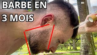 Pourquoi le Minoxidil Conflugain est la solution pour faire pousser ta barbe rapidement [upl. by Huston128]