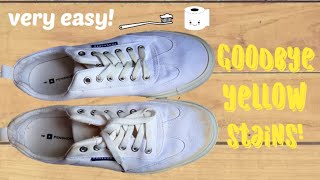 How to remove yellow stains from white shoes quotTISSUE METHODquot Very effective [upl. by Asel784]