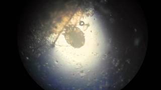 Scabies Mite Video HD [upl. by Atinauj885]