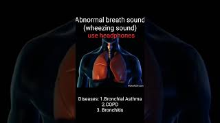 Wheezingabnormal breath soundAsthmaCOPDBronchitisHow to different wheezing soundMed school way [upl. by Elkraps]